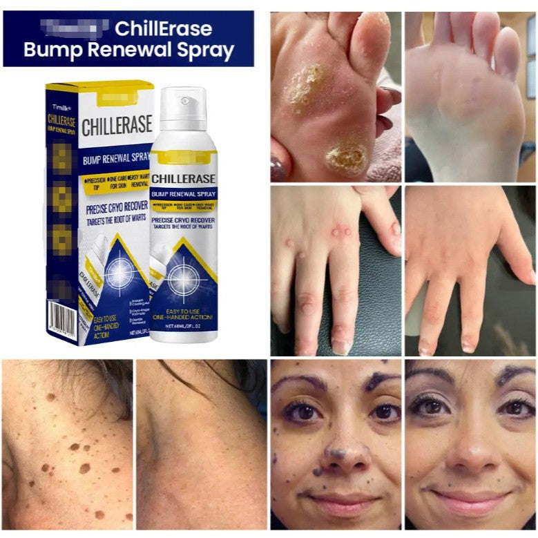 CryoCure